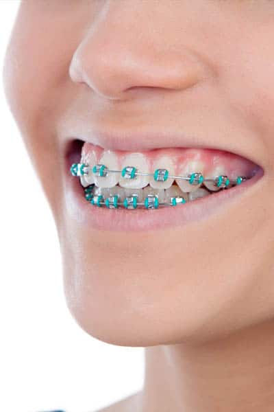 funcional-maxilares-dente