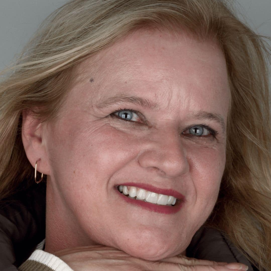 “Bendito seja o profissional que tem todos os dias a melhor recompensa de um paciente; o sorriso! Obrigada equipe Espada por me proporcionar o melhor sorriso.”, Mirian Marques Oliveira