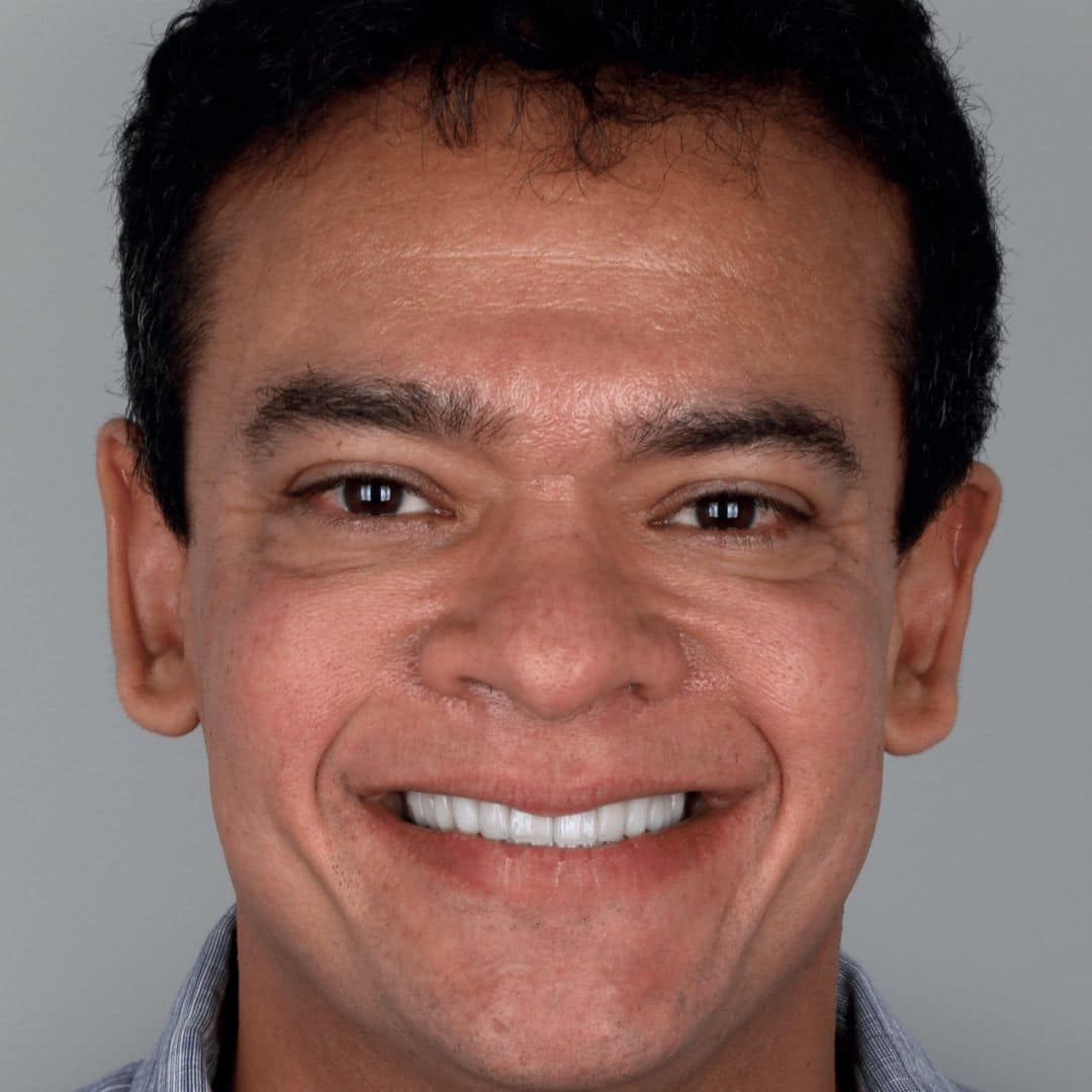 “Estou extremamente feliz com meu sorriso novo e cuidados que a equipe da Odontologia Espada me proporcionou.”, Rodrigo Otávio Silva e Gonzales