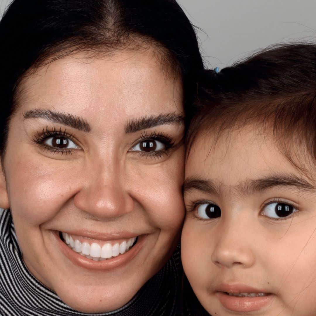 “Devido ATM (agora corrigida) meus dentes sofreram um desgaste significante dificultando a mastigação, fala e estética do meu sorriso. Dra. Adriana Espada me recomendou as facetas. Desde a minha primeira vez no consultório, há 12 anos atrás, além do trabalho impecável que ela realiza, fiquei encantada com o atendimento, carinho e acolhimento da doutora. E então sem hesitar realizei minhas facetas e estou apaixonada pelo meu sorriso. Ficou muito além do que eu esperava! Agradeço a Dra. Adriana e toda equipe Espada por devolver meu sorriso e junto com ele minha auto estima e confiança.”, Reni Angela de Carvalho